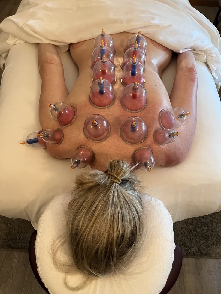 Cupping: wat is het en waarom wordt het gebruikt?
